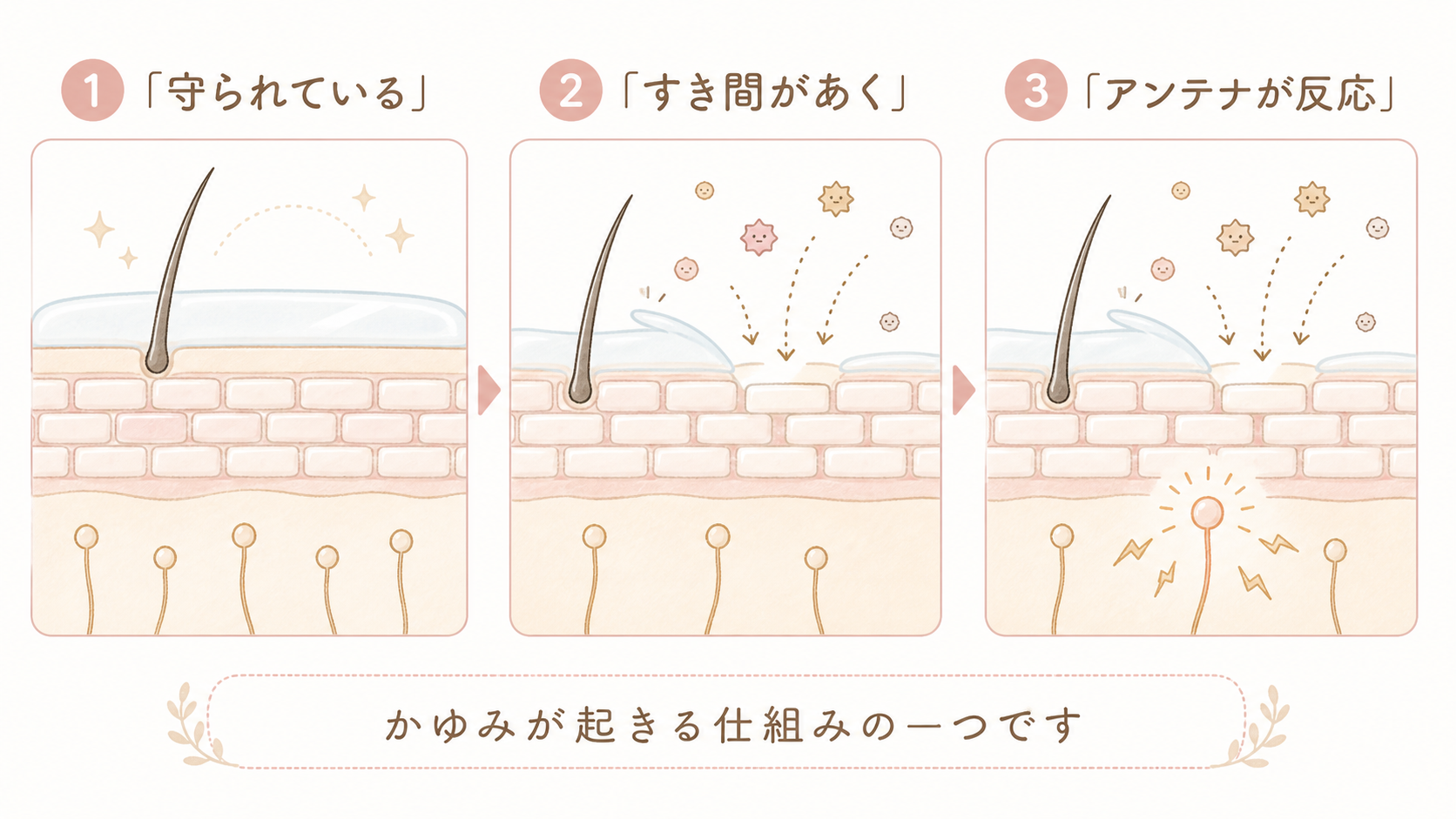 頭皮のバリアが乱れてかゆみが起きる仕組みの一例